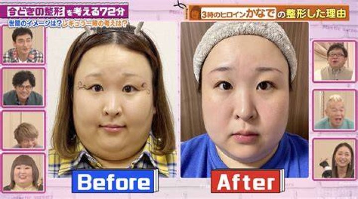 整形前の噂を読み解くときに、一次情報や根拠の確認を促すイメージ